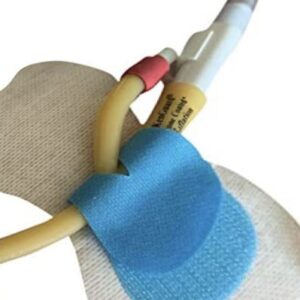 Prostate Cancer Catheter Problems