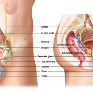 Hernia Mesh Cause Prostate Problems