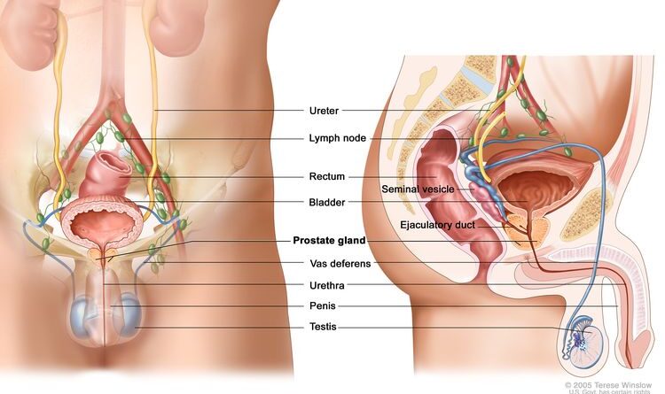 Hernia Mesh Cause Prostate Problems